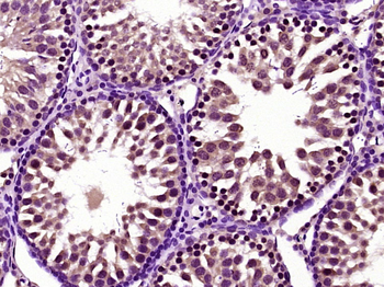 TFAR19/PDCD5 Rabbit Polyclonal Antibody