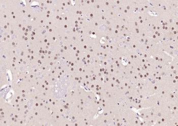FOXO1A Rabbit Polyclonal Antibody