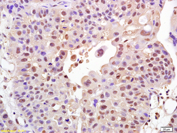 FOXO1A Rabbit Polyclonal Antibody