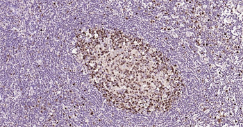 PCNA Rabbit Polyclonal Antibody