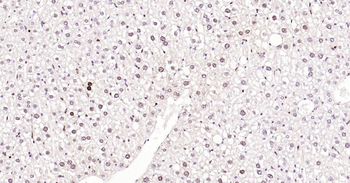 PCNA Rabbit Polyclonal Antibody