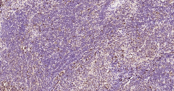 PCNA Rabbit Polyclonal Antibody