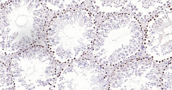 PCNA Rabbit Polyclonal Antibody