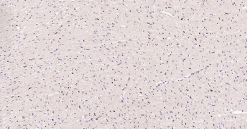 PCNA Rabbit Polyclonal Antibody