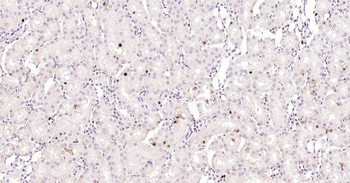 PCNA Rabbit Polyclonal Antibody