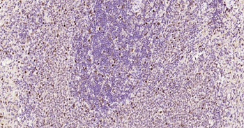 PCNA Rabbit Polyclonal Antibody