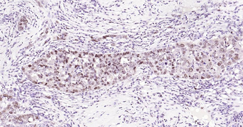 PCNA Rabbit Polyclonal Antibody