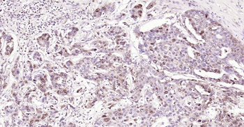 PCNA Rabbit Polyclonal Antibody