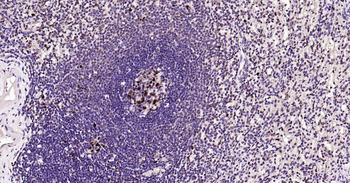 PCNA Rabbit Polyclonal Antibody