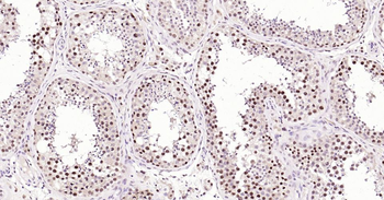 PCNA Rabbit Polyclonal Antibody