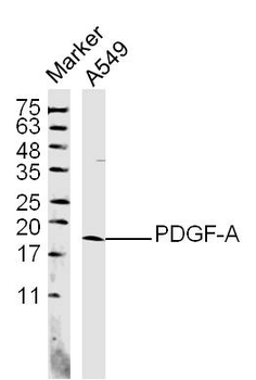 PDGF-A Rabbit Polyclonal Antibody
