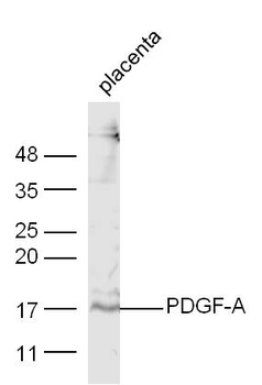 PDGF-A Rabbit Polyclonal Antibody