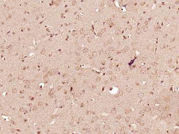 PDGFBB Rabbit Polyclonal Antibody