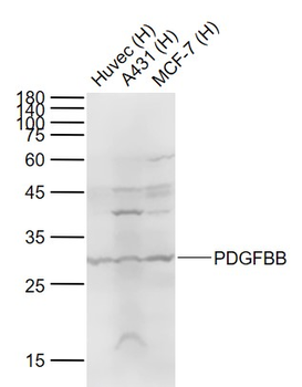 PDGFBB Rabbit Polyclonal Antibody