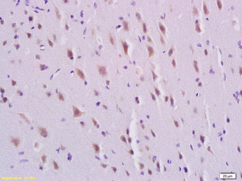 PDGFBB Rabbit Polyclonal Antibody