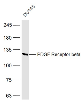 PDGF Receptor beta Rabbit Polyclonal Antibody