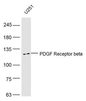 PDGF Receptor beta Rabbit Polyclonal Antibody