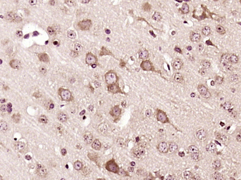P4HB Rabbit Polyclonal Antibody