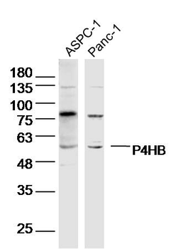 P4HB Rabbit Polyclonal Antibody