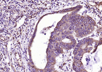 PEPT1 Rabbit Polyclonal Antibody