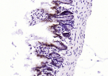 PEPT1 Rabbit Polyclonal Antibody