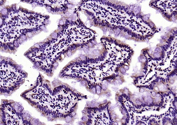 PEPT1 Rabbit Polyclonal Antibody