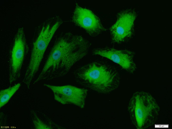 Phospho-FSCN1 (Ser39) Rabbit Polyclonal Antibody