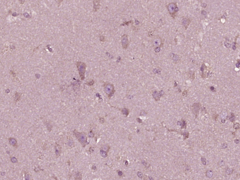 Phospho-FSCN1 (Ser39) Rabbit Polyclonal Antibody