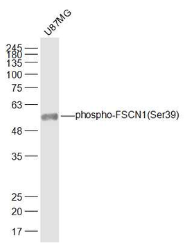 Phospho-FSCN1 (Ser39) Rabbit Polyclonal Antibody
