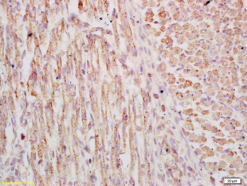 Phospho-FSCN1 (Ser39) Rabbit Polyclonal Antibody