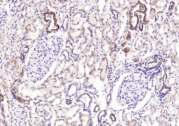GPLD1 Rabbit Polyclonal Antibody
