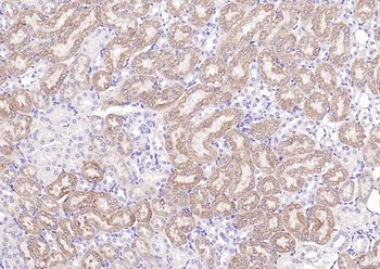 GPLD1 Rabbit Polyclonal Antibody