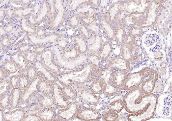 GPLD1 Rabbit Polyclonal Antibody