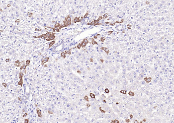 GPLD1 Rabbit Polyclonal Antibody