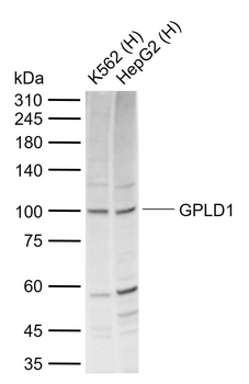 GPLD1 Rabbit Polyclonal Antibody
