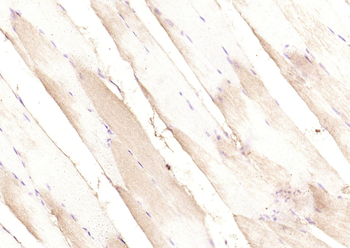 PIK3R1 Rabbit Polyclonal Antibody