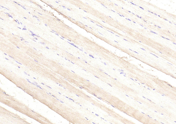 PIK3R1 Rabbit Polyclonal Antibody