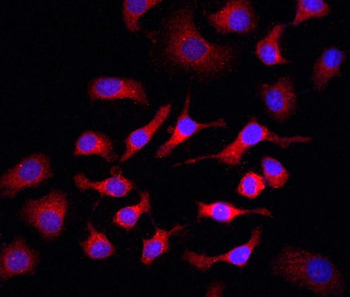 PIK3R1 Rabbit Polyclonal Antibody