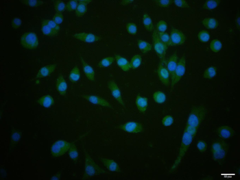 PIK3CA Rabbit Polyclonal Antibody