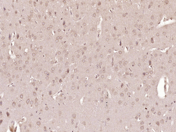 PIK3CA Rabbit Polyclonal Antibody