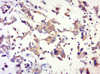 AKT1 Mouse Polyclonal Antibody