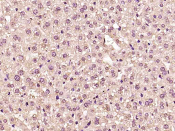 AKT1 Mouse Polyclonal Antibody