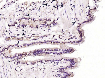 AKT1 Mouse Polyclonal Antibody