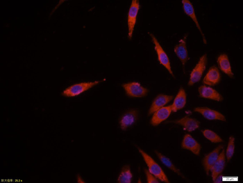 AKT1 Mouse Polyclonal Antibody