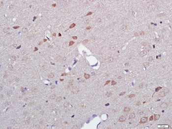 Podoplanin Rabbit Polyclonal Antibody