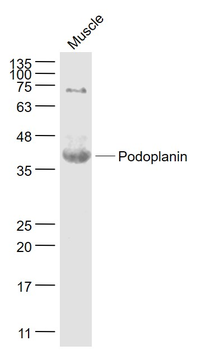 Podoplanin Rabbit Polyclonal Antibody