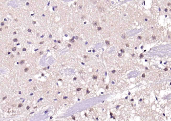 PP2A alpha + beta Rabbit Polyclonal Antibody