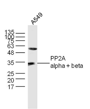 PP2A alpha + beta Rabbit Polyclonal Antibody