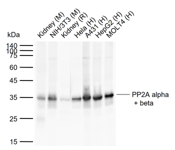 PP2A alpha + beta Rabbit Polyclonal Antibody