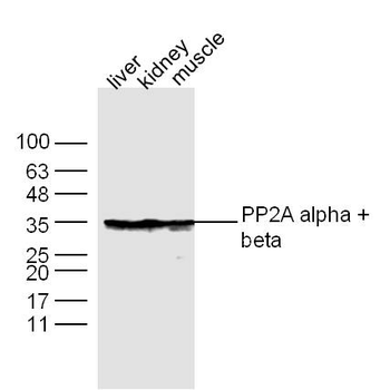 PP2A alpha + beta Rabbit Polyclonal Antibody